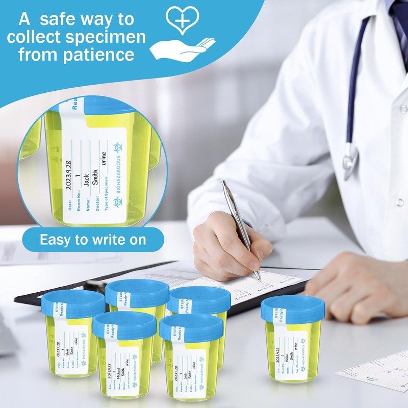 200 Pcs Urine Specimen Cups with Lids and Evident Seal Urine Sample Cups Coll... gallery